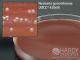 Martin Lewis w/Lincomycin; HDx, 15x100mm plate     R