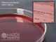 EMB Levine Agar; HDx, 15x100mm plate R