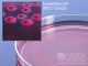 Violet Red Bile Agar; HDx, 15x100mm plate     R