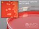 GBS Detect (RSR); HDx,15x100mm plt, 10/pk R