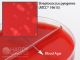 Blood/Blood Agar, 5%; HDx, 15x100mm biplate   R