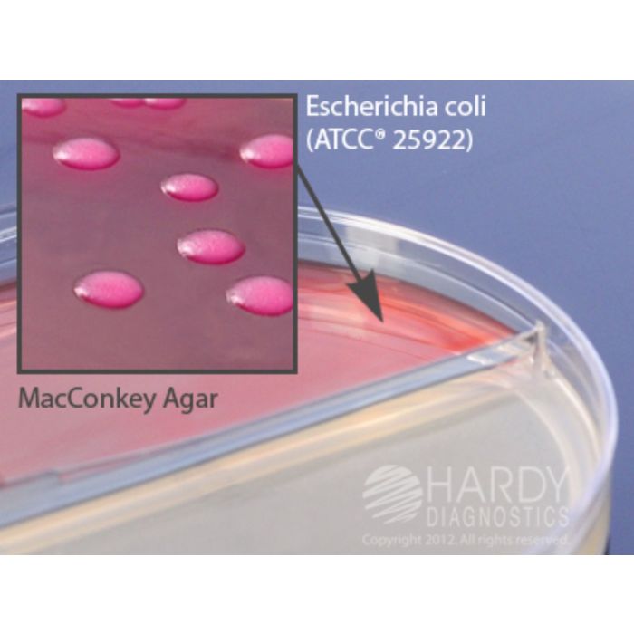 Ba Plate Blood Agar Hardy Diagnostics Plates - 5% 15x100mm Biplate, Package Of ...